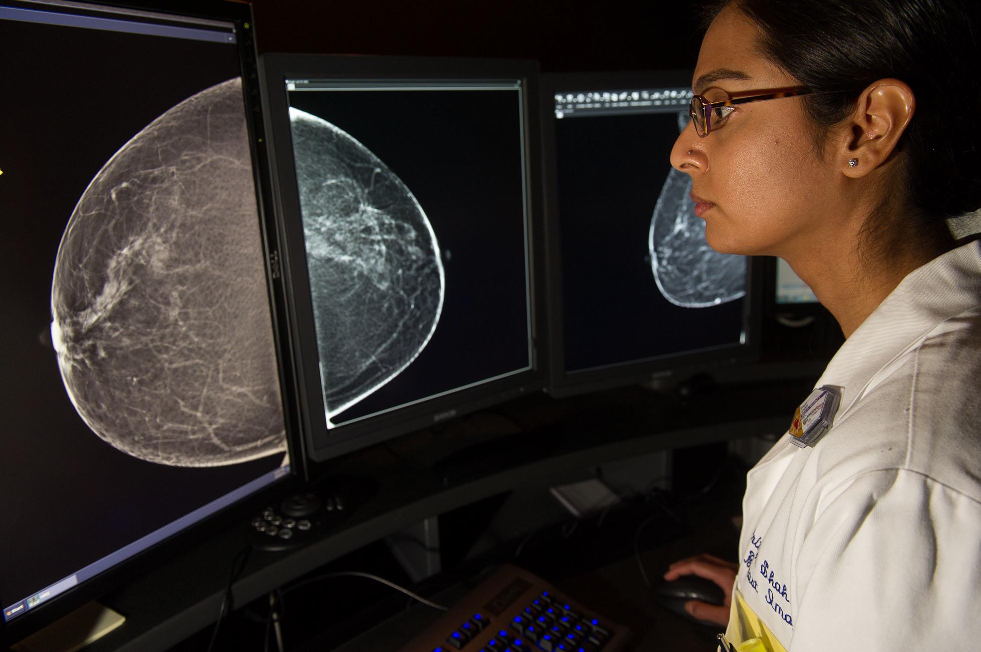 Breast MRI.